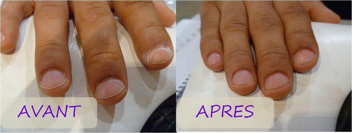 A Quoi Sert L'acrylique Pour Les Ongles Fluffy Nails: A quoi ça sert, une manucure?