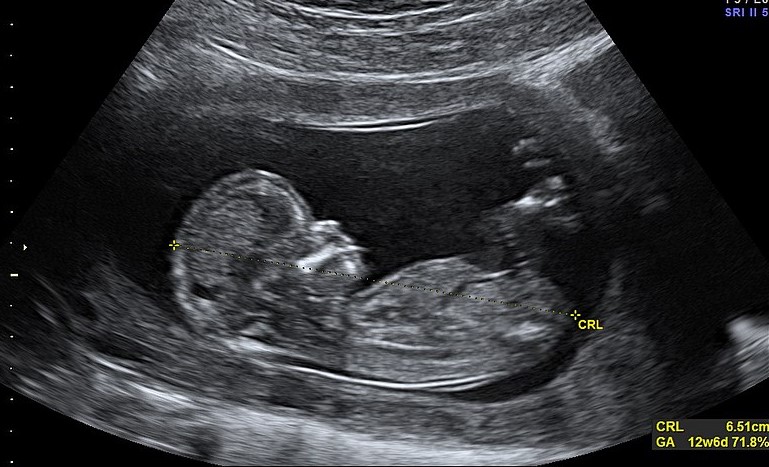 ULTRASOUND - PART 1