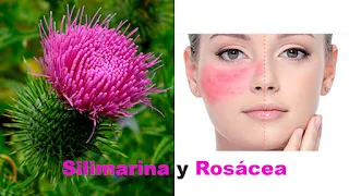 Silimarina y rosacea