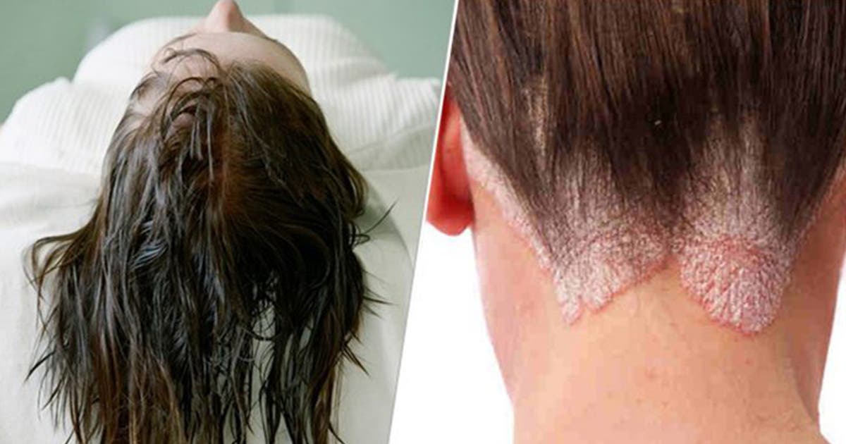7 ILLNESSES CAUSED BY SLEEPING WITH WET HAIR