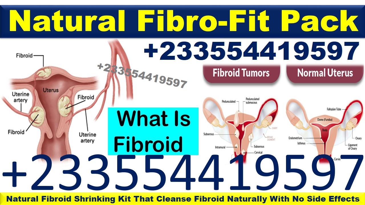 Natural remedy for Fibroid removal
