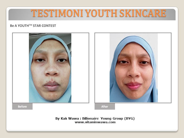 34 Testimoni Youth Skincare Shaklee Terbaru, Youth skincare shaklee, testimoni youth skincare shaklee, Youth Skincare Shaklee : Harga dan Review Pengguna Youth Shaklee, testimoni youth skincare shaklee, testimoni youth skincare shaklee 34 Testimoni Youth Skincare Shaklee Terbaru, Youth skincare shaklee, testimoni youth skincare shaklee, Youth Skincare Shaklee : Harga dan Review Pengguna Youth Shaklee, testimoni youth skincare shaklee, testimoni youth skincare shaklee