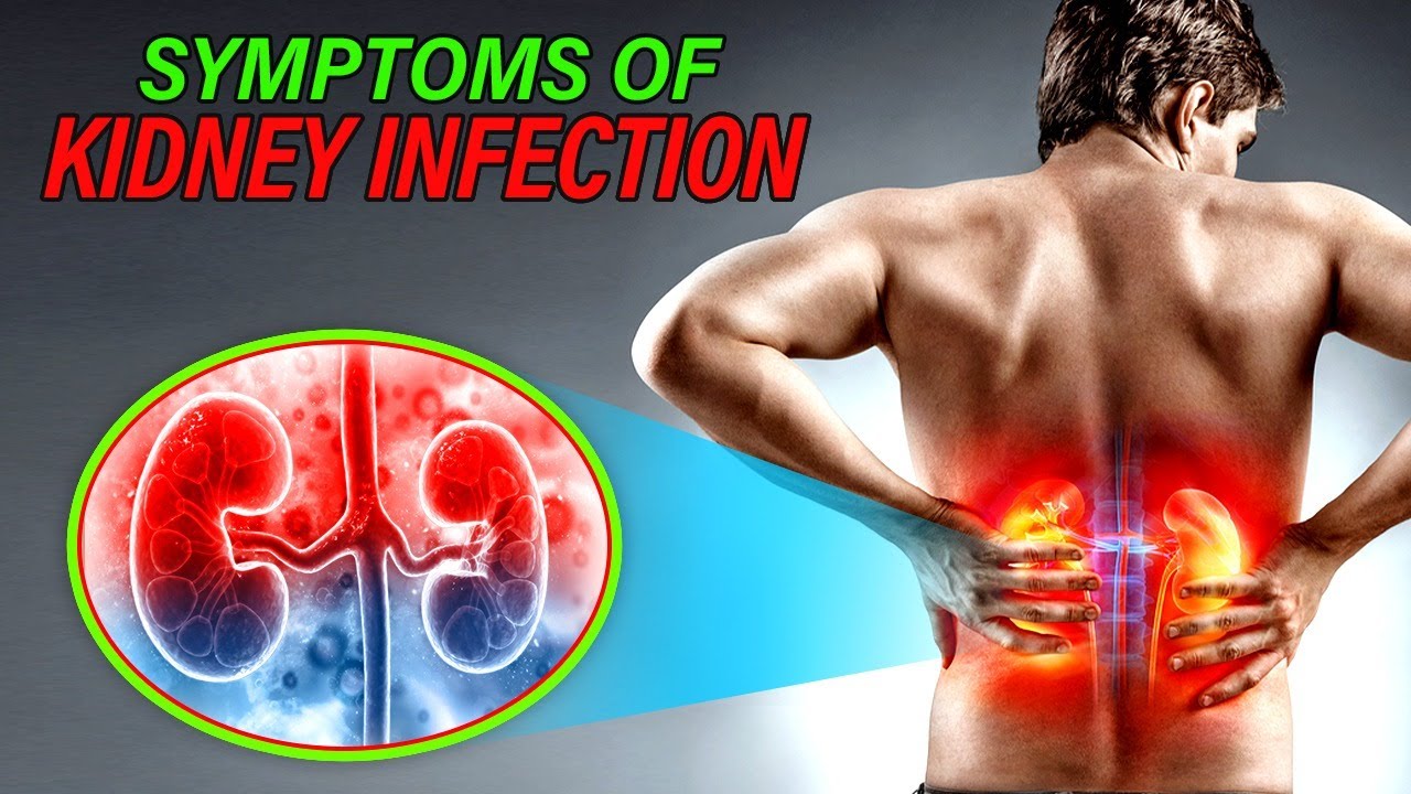 BEST NATURAL REMEDY FOR KIDNEY INFECTIONS