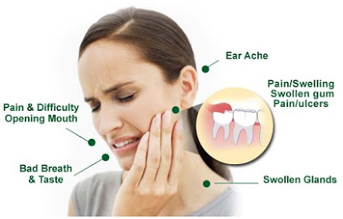 wisdom tooth symptoms