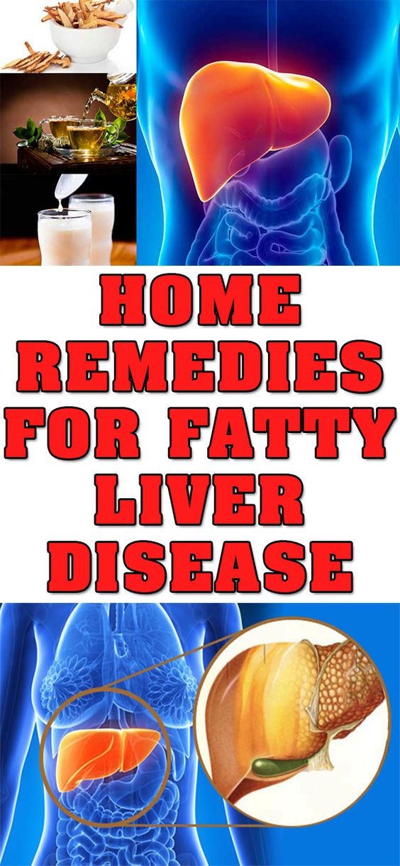 HOME REMEDIES FOR FATTY LIVER DISEASE HEALTH CAPLET