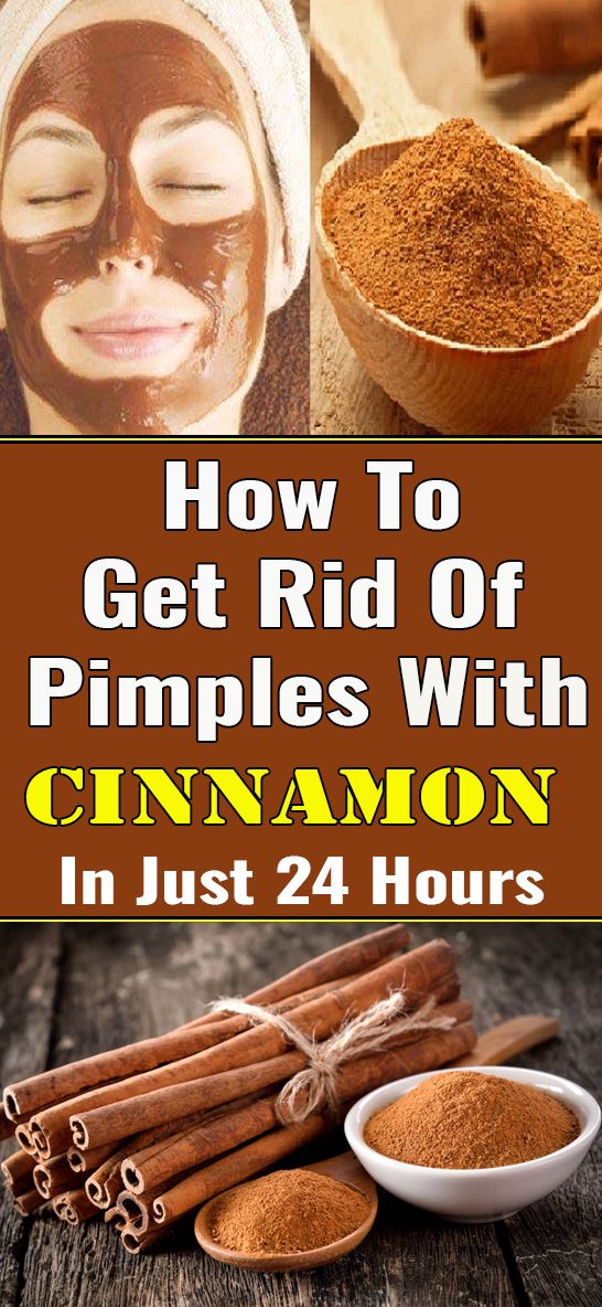 How To Get Rid Of Pimples With Cinnamon Wellness Know