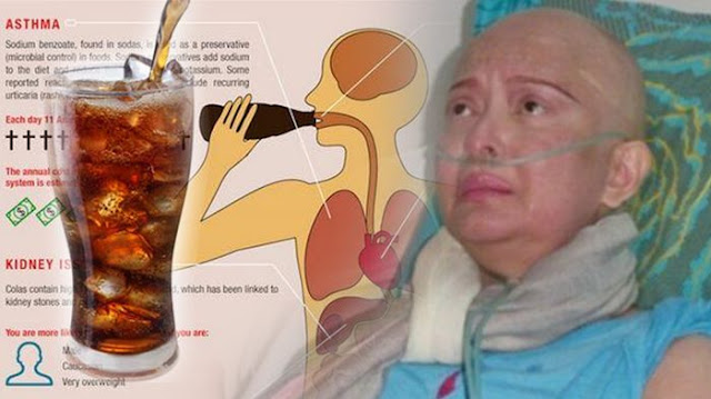 Sudah Diingatkan Ilmuan Amerika , Minuman Kesukaan Yana Zein Ini Ternyata Pembawa Kanker Payudara, Lihat Hasilnya! Sudah Diingatkan Ilmuan Amerika , Minuman Kesukaan Yana Zein Ini Ternyata Pembawa Kanker Payudara, Lihat Hasilnya!