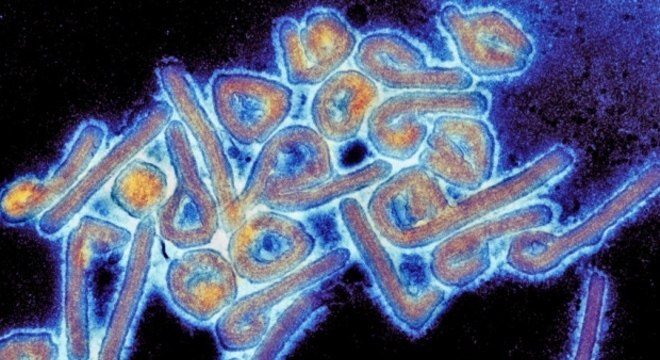  Vírus mortal encontrado na Bolívia é transmissível entre humanos
