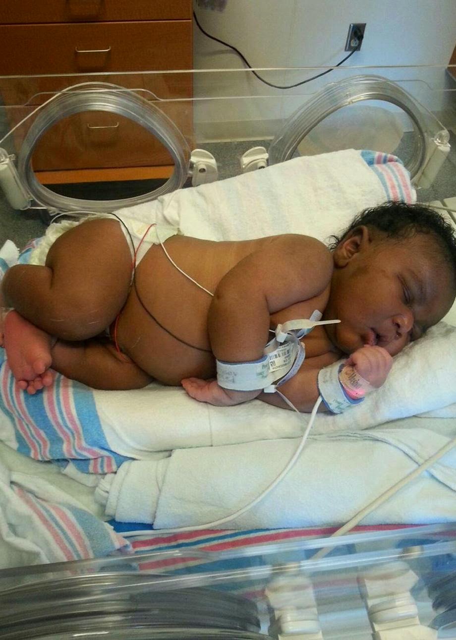 babyreal Photos: Florida mom sets record with 14 pound baby boy