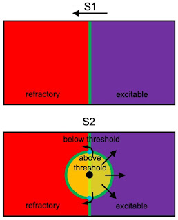 A schematic illustration of the critical point hypothesis. The top panel shows the S1 wave front just before the S2 stimulus. The bottom panel shows the tissue just after the S2 stimulus, and the resulting reentry.