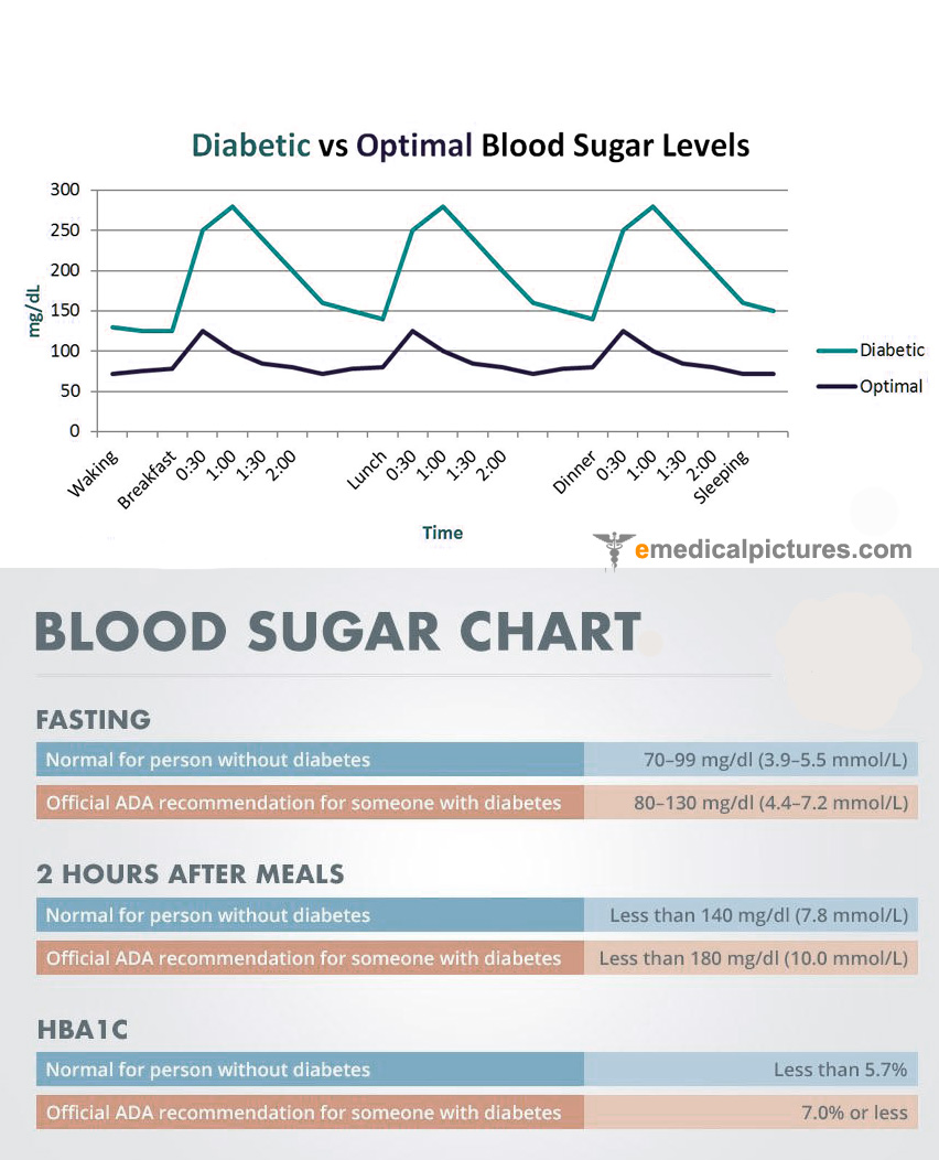 Diabetes Sugar Levels Chart Canada