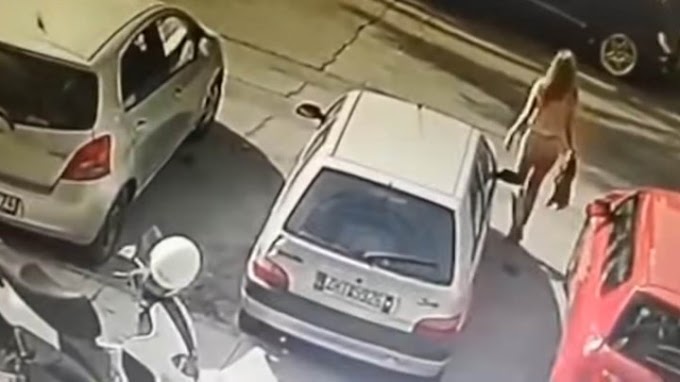 Επίθεση με βιτριόλι - Συγκλονίζει η 34χρονη: Με κοίταξε για δευτερόλεπτα στα μάτια και μου πέταξε το υγρό