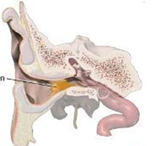 symptoms of inner ear infection