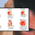 Know How To Recognize What Types Of Headaches Are Dangerous and Serious
