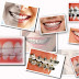 Những ảnh hưởng của răng móm gây ra