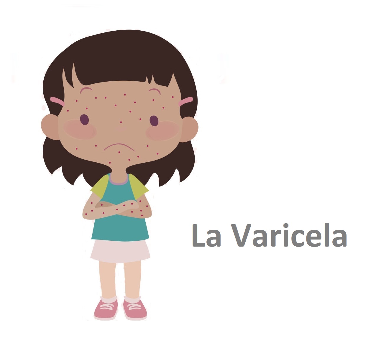 la varicela