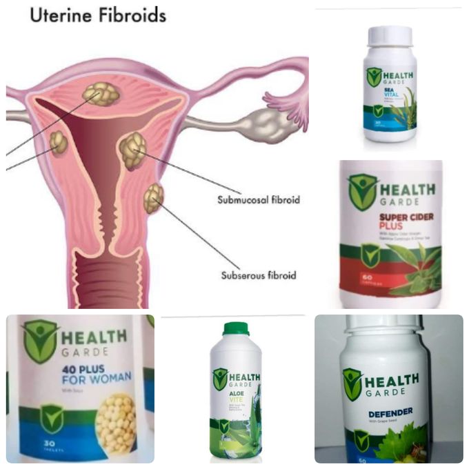 Healthgarde Fibroids Pack Shrink Fibroids, Its A Tumor Crusher It Break