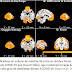 COVID-19 pode causar redução no volume de matéria cinzenta do cérebro
