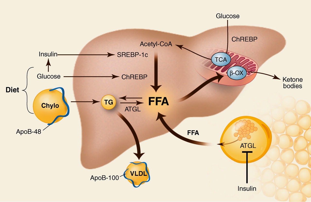 Fat Infiltration Of Liver 17