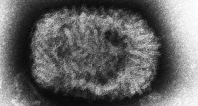 Virus Cacar Smallpox