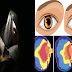 Two Women Loss Their Vision After Using Their Mobiles For Too Long in A Dark Area