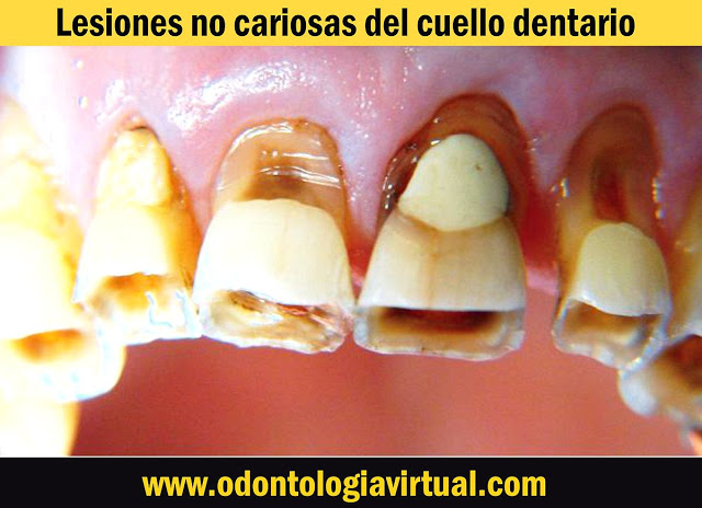 Barrancos mooney operatoria dental descargar pdf gratis