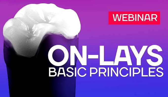 WEBINAR: ON-Lays - Basic principles - BELOGRAD Academy