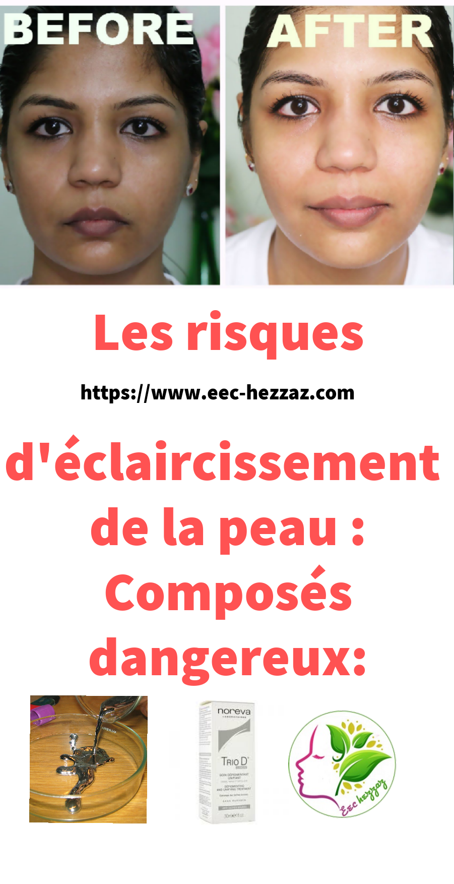 Les risques d'éclaircissement de la peau : Composés dangereux: