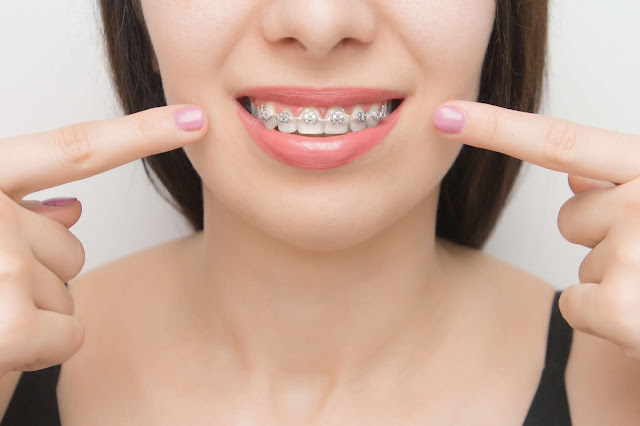 leczenie zębów z aparatem ortodontycznym nie jest problemem dla dentystów