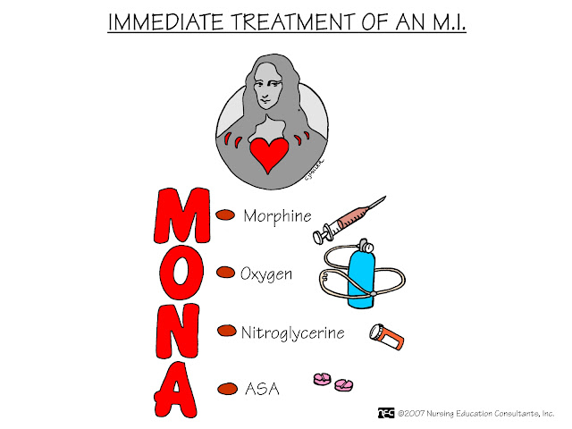 Infarction Post Myocardial Infarction Treatment