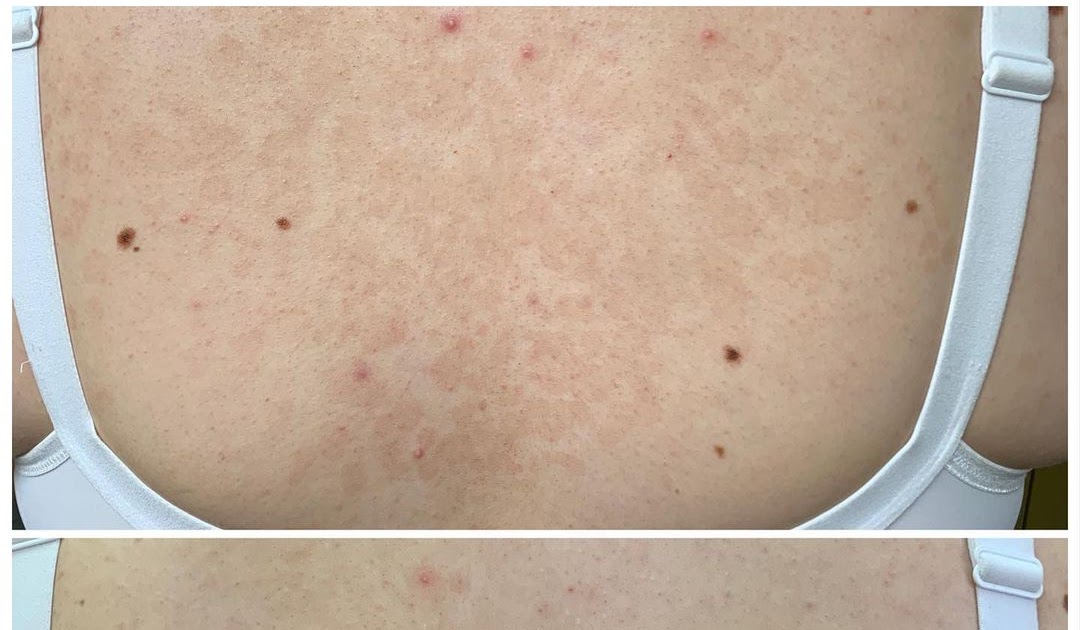 Des aliments avec des propriétés efficaces dans le traitement du