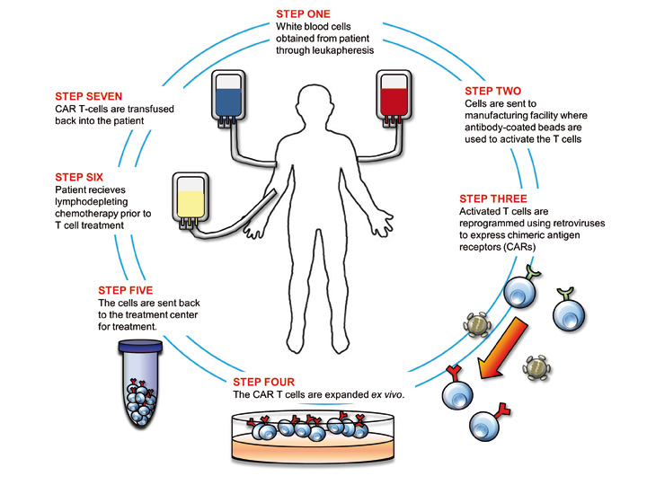 My Cancer Pilgrimage CAR TCell Therapy for Lymphoma