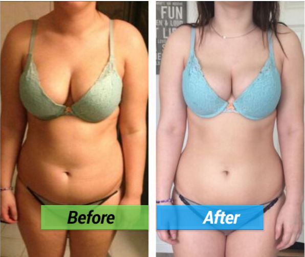 The Lean Belly Breakthrough Is The Solution You Have Been Looking For