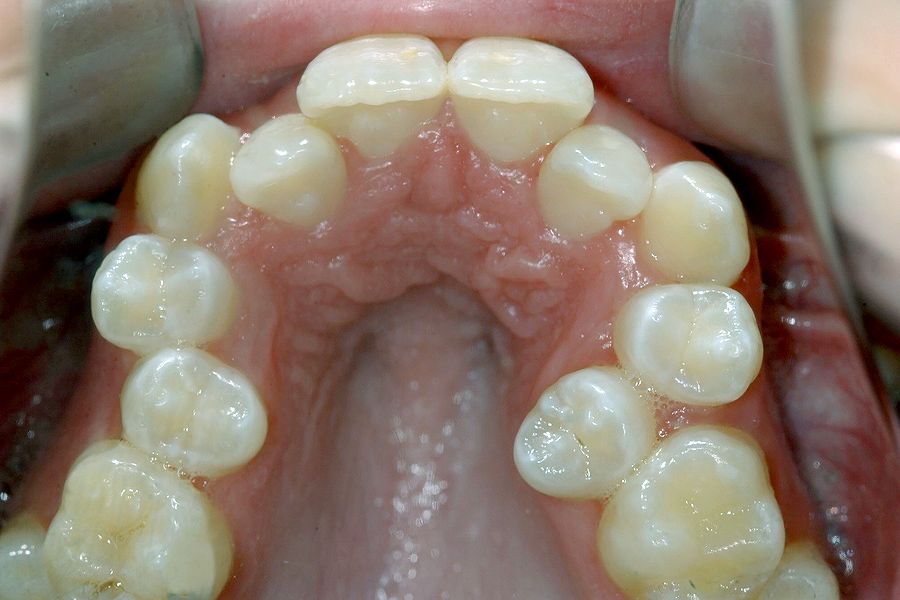 PDF Extraction Planning in Orthodontics Ovi Dental