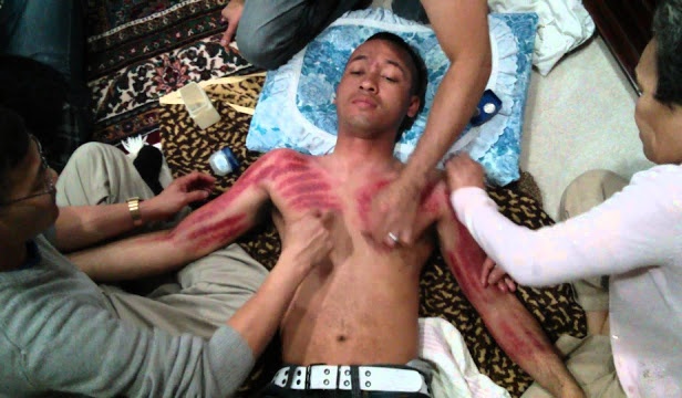 Masuk Angin Pembawa Maut Quot Angin Duduk Quot Dan Cara Mengatasinya Tolong Disebar Luaskan