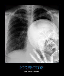 Los Jode Fotos : Radiografia