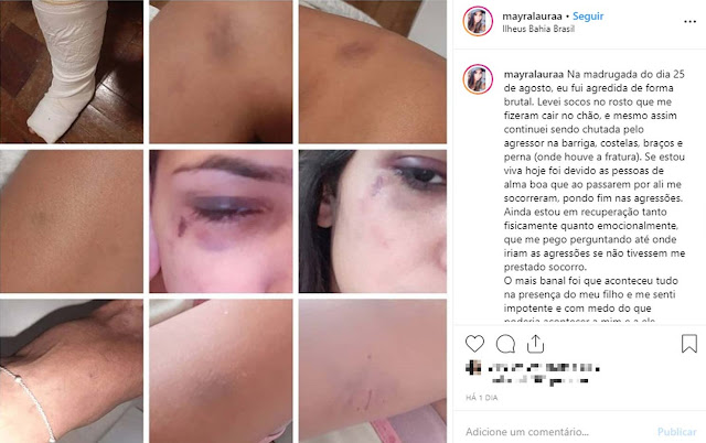 Jovem denuncia ter sido espancada na frente do filho por ex-companheiro em Ilhéus