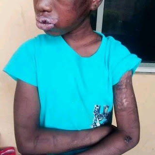 Photos: Heartless woman poured hot water mixed with pepper on 10 years old maid. (4)