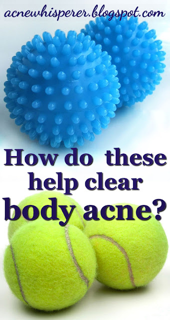 How do these unrelated items help clear body acne?  Find out more!