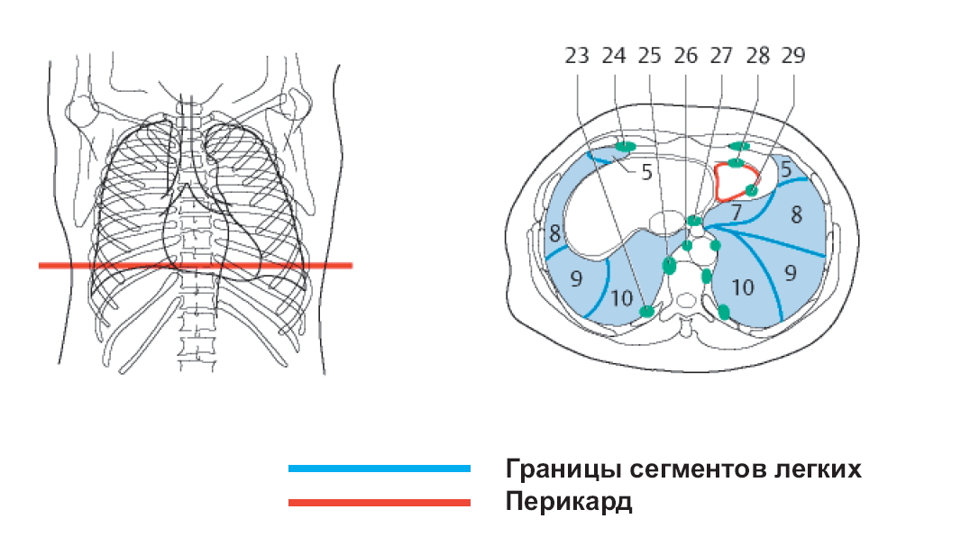 Схема кт. Сегменты лёгких на кт аксиальный срез. Кт грудной клетки срезы аксиальные. Аксиальная проекция кт легких. Аксиальный срез кт легкие.