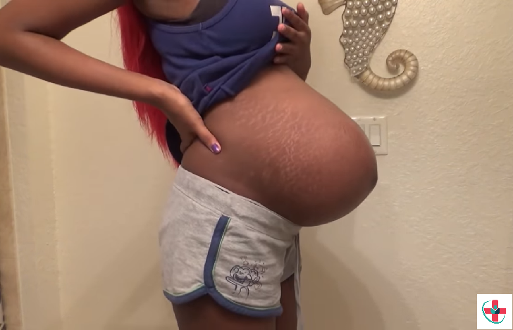 Pregnancy bump.