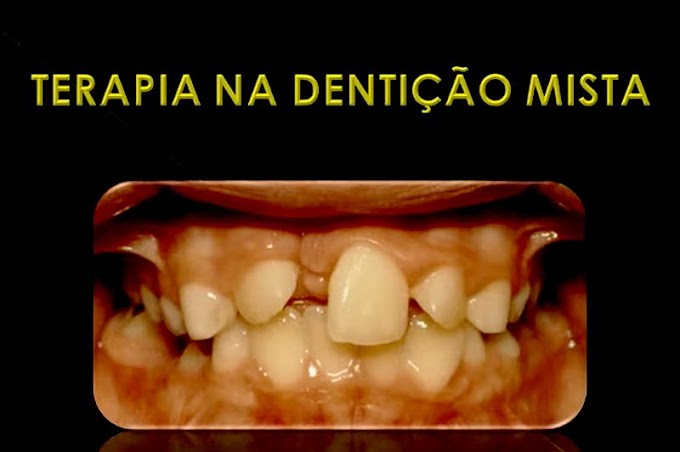 ORTODONTIA: Terapia na dentição mista - José Carlos Lago