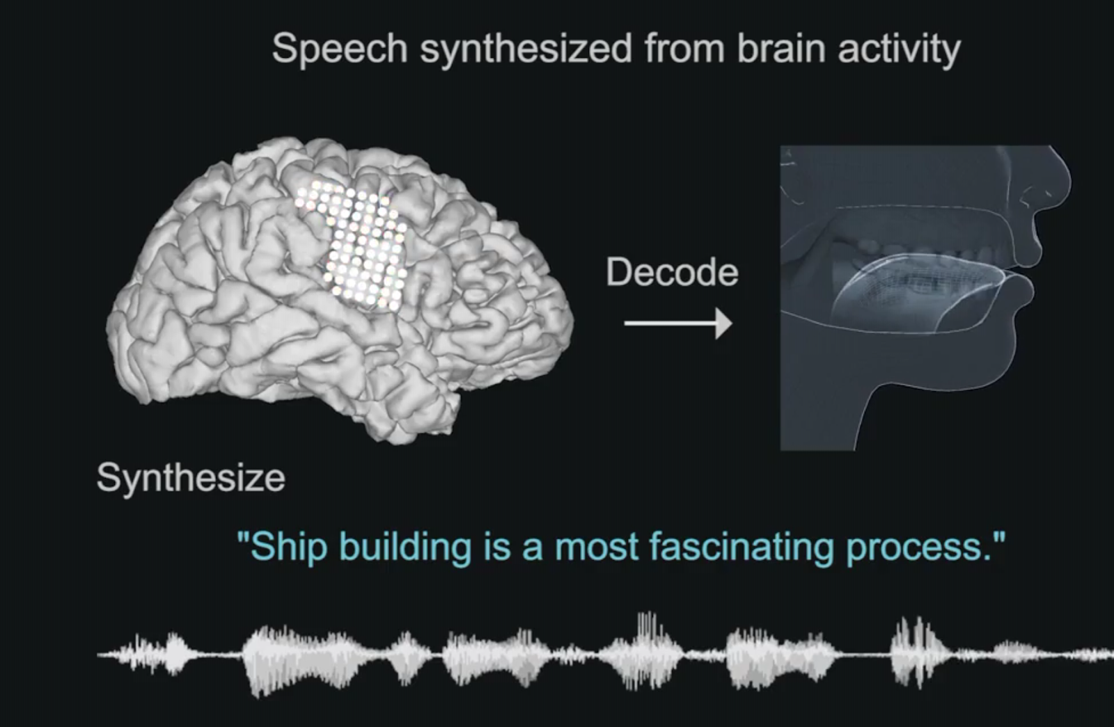 Brain sentences. Speech Synthesis. Brain activity. Мозг и Ноты вокруг. Синтез речи картинки.