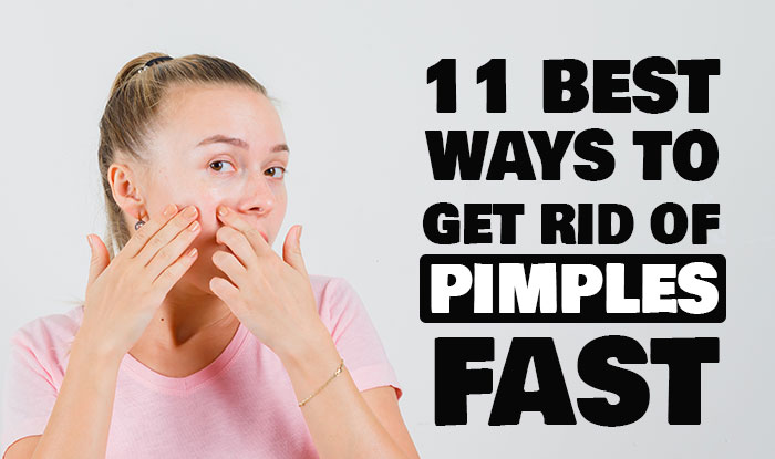 Best 11 Ways to Get Rid of Pimples Fast