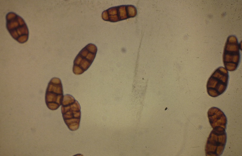 Woolshed 1 Facial eczema NZ disease scourge for 100 years