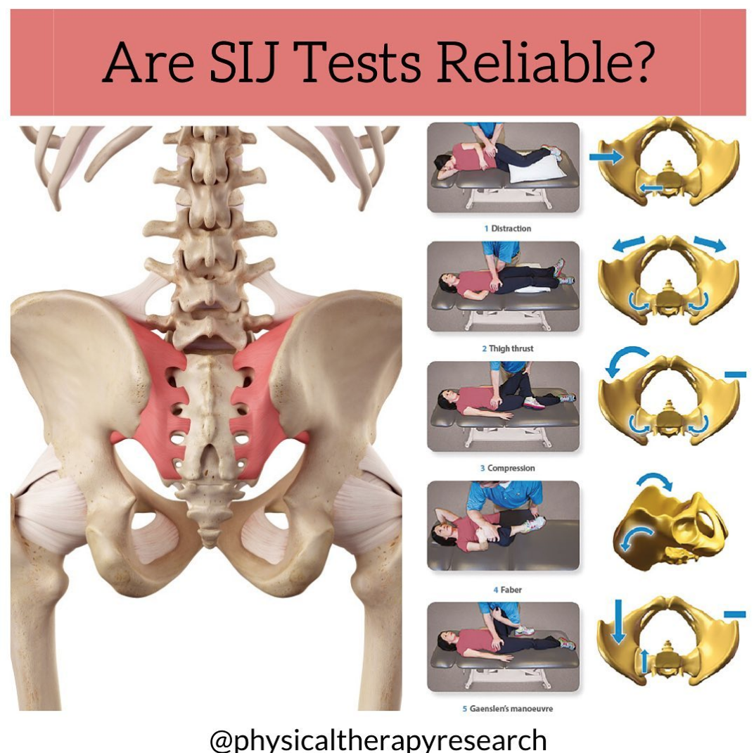 kun Bevidst Forbigående Are SIJ Tests Reliable? | Modern Manual Therapy Blog - Manual Therapy,  Videos, Neurodynamics, Podcasts, Research Reviews