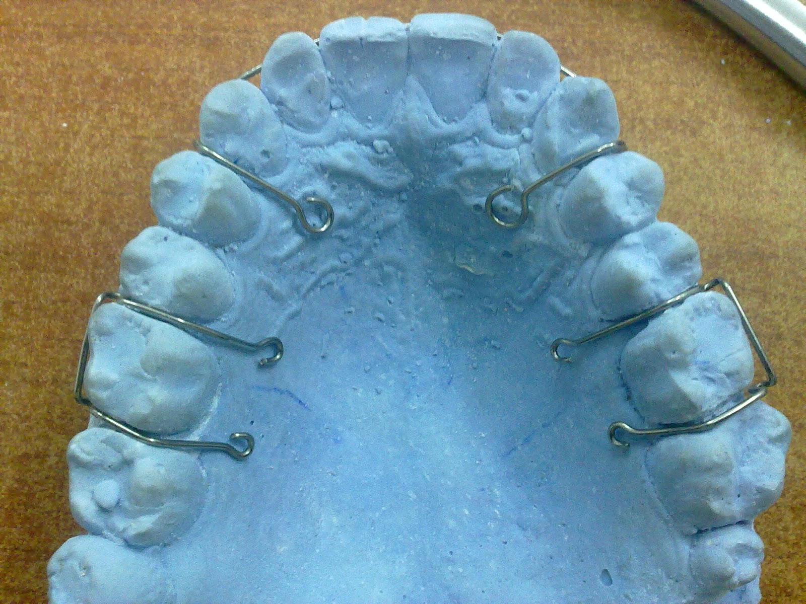 جهاز التثبيت (retainer) Smile maker