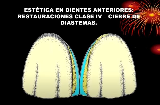 WEBINAR: Manejo de tintes para maquillaje de composites - Dr. Octavio Crespo Knopfler