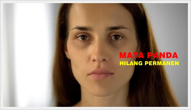 Cara Menghilangkan Mata Panda Secara Alami Dan Cepat Merdeka Com