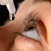 How to Use Brinzolamide Eye Drops Treatments (Azopt)